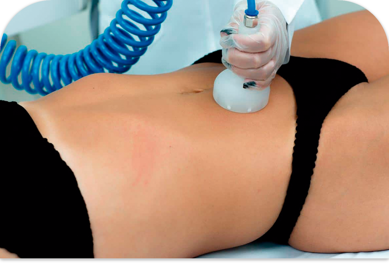 Foto Endermoterapia